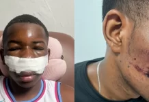 Conductor huye tras embestir buggy en Punta Cana y deja dos jóvenes heridos