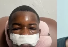 Conductor huye tras embestir buggy en Punta Cana y deja dos jóvenes heridos