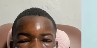 Conductor huye tras embestir buggy en Punta Cana y deja dos jóvenes heridos