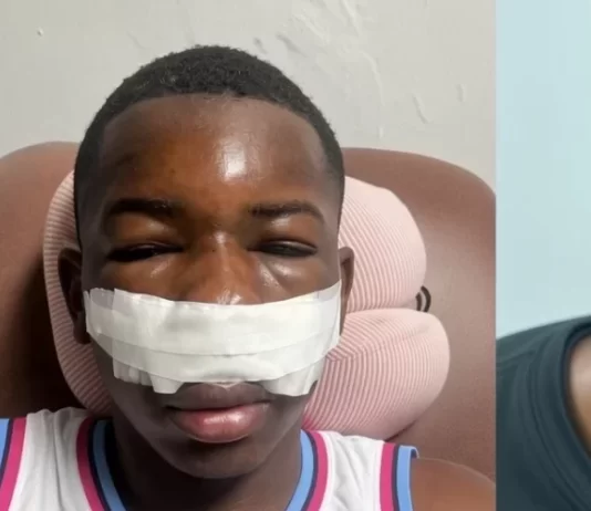 Conductor huye tras embestir buggy en Punta Cana y deja dos jóvenes heridos