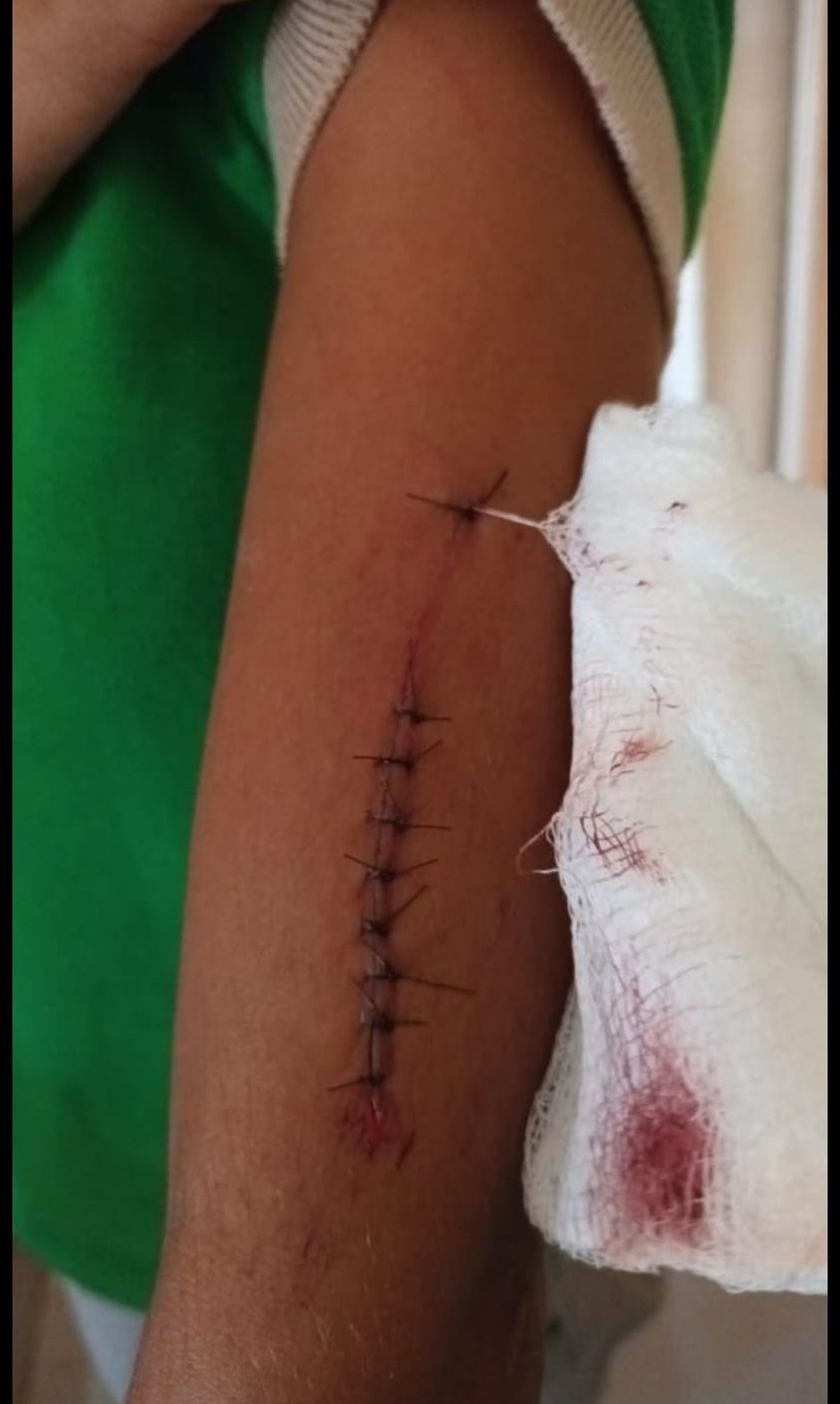 Una estudiante de 15 años agredió a otra de 14 con un arma blanca en Higüey