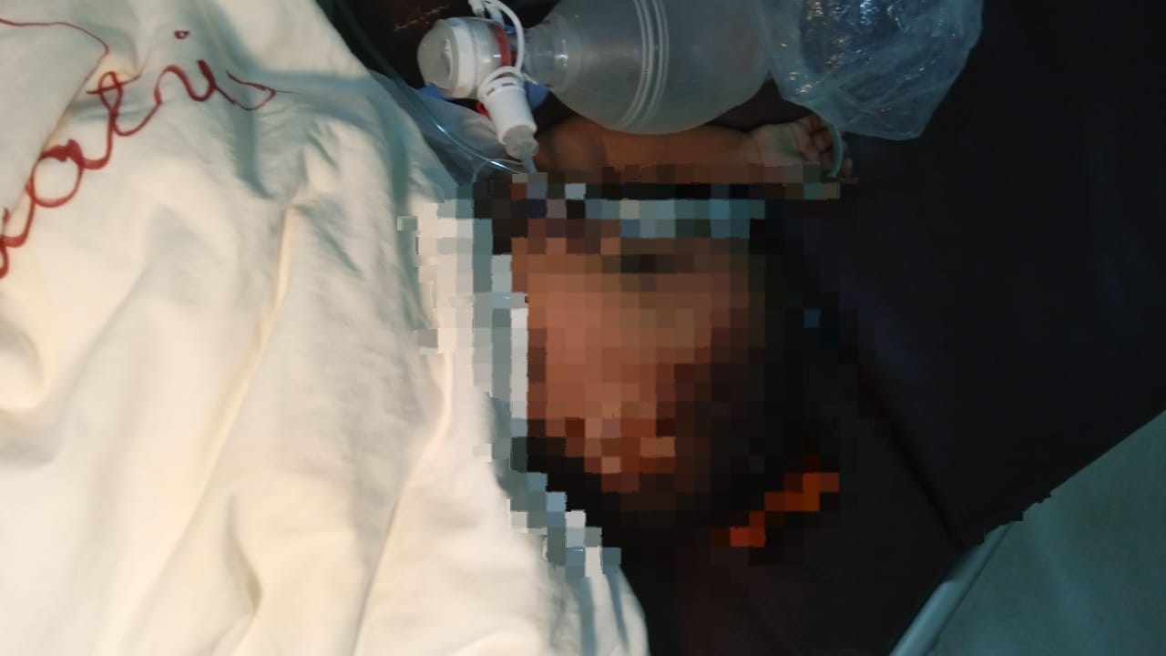 Tragedia en San Pedro de Macorís: Niña pierde la vida en un trágico accidente por ahogamiento en una piscina