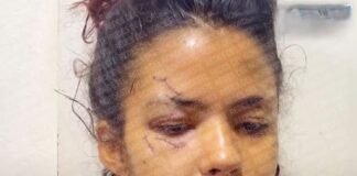 Joven que perdió embarazo tras recibir 42 puñaladas por su pareja rompe el silencio, esperando que luego de lo ocurrido este pueda cambiar