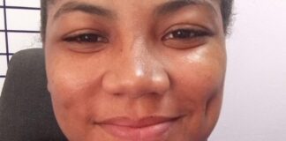 Joven de Él Valle resulta atropellada por un vehículo en Bávaro