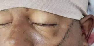 Violento enfrentamiento en discusión por juego de dominó deja dos hombres heridos en el distrito municipal Los Botados