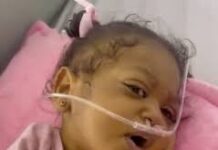 Piden ayuda urgente para niña que necesita trasplante de hígado