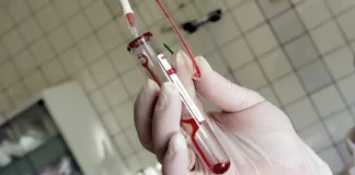 El número de contagios de VIH en Rusia se reduce a la mitad en la última década