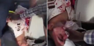 Personas y paredes cubiertas de sangre durante emergencia del avión con destino a Israel